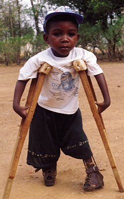 Little Benjamin makes his way with courage and determination. Sr. Rosemarie writes:  'He was born with clubbed hands and feet and was eight months old when I first saw him. After two operations and multiple castings on his feet he is walking with the help of callipers and crutches.'